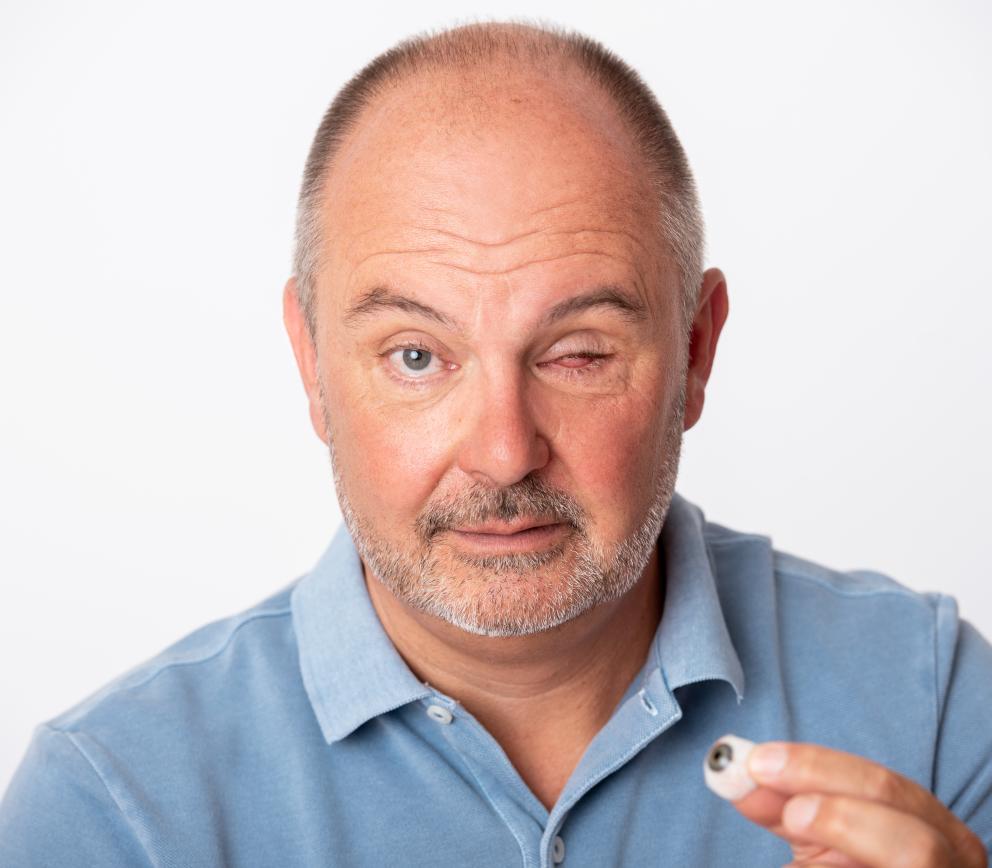 Frank Schädel ohne Glasauge